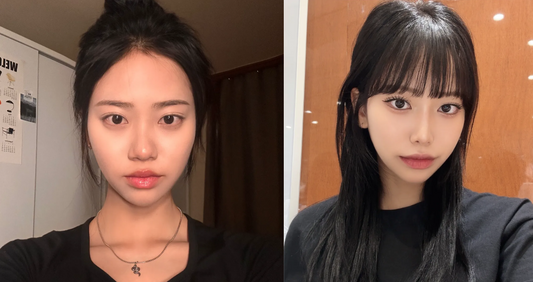 korean nose job before after