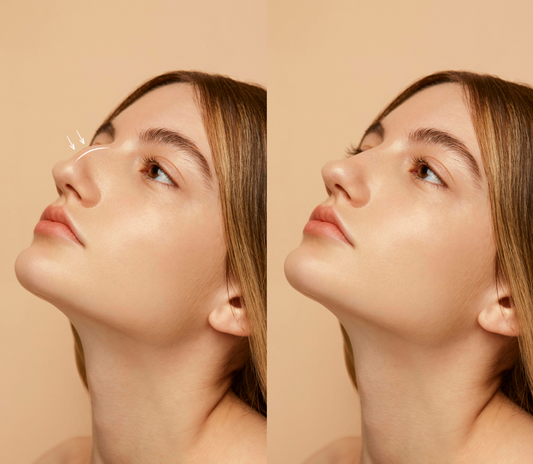 korean nose job cost