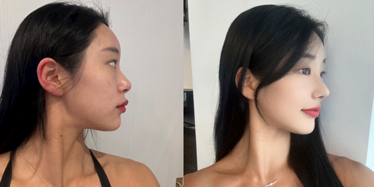 Tiana Plastic Surgery