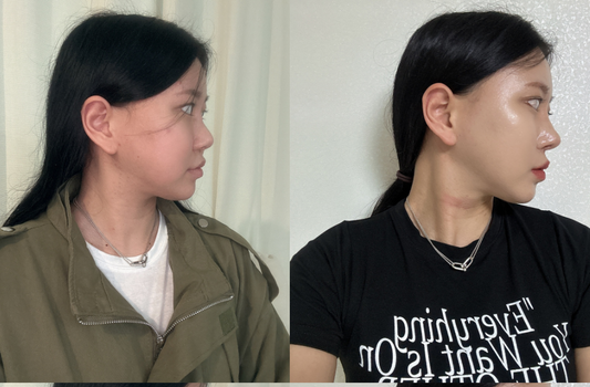 Tiana Plastic Surgery