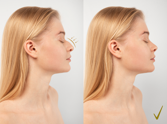 korean nose job